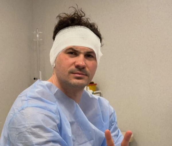 Женя Кот після хірургічного втручання: танцівник поділився самопочуттям, продемонструвавши забинтовану голову.